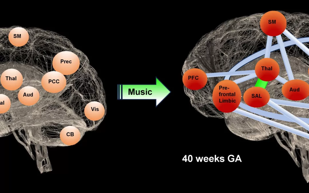 Music Boosts Brain Development in Premature Babies, Study Finds