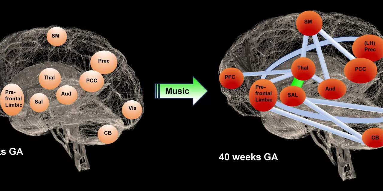 Music Boosts Brain Development in Premature Babies, Study Finds