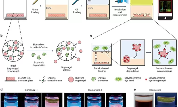 Urine-based bladder cancer diagnostic kit for home use developed