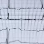 Obesity and Heart Rhythm: New Insights into a Dangerous Link