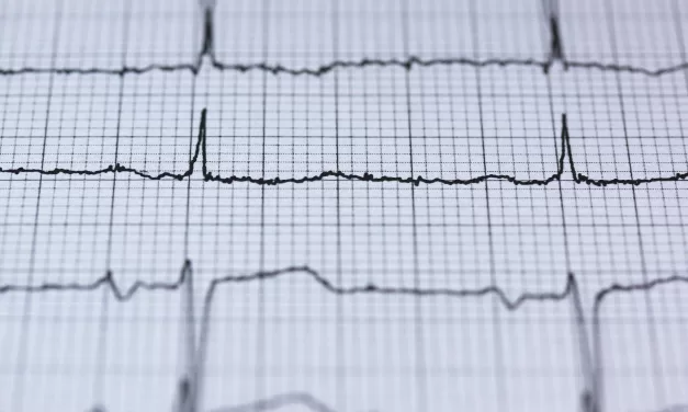 Obesity and Heart Rhythm: New Insights into a Dangerous Link