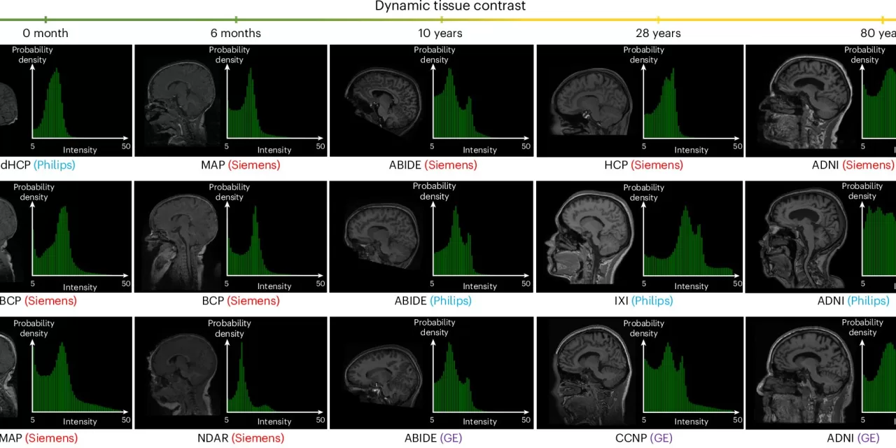 AI Revolutionizes MRI Brain Imaging