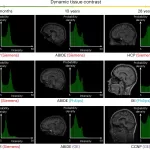 AI Revolutionizes MRI Brain Imaging