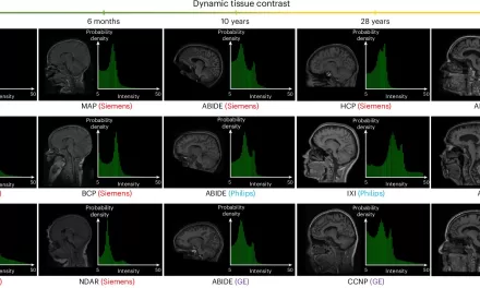 AI Revolutionizes MRI Brain Imaging