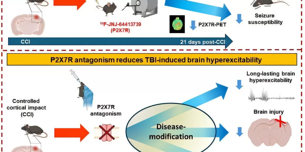 Brain Receptor Study Offers Hope for Preventing Epilepsy After Traumatic Brain Injury