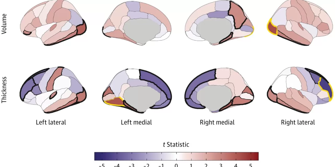 Study Sheds Light on Brain Structure’s Role in Early Substance Use