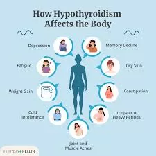 Could You Have Hypothyroidism? Understanding the Symptoms and Seeking Treatment