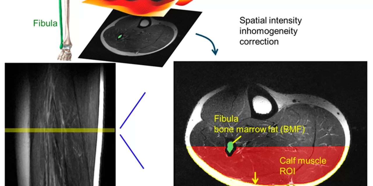 Study Reveals How Sex and Age Influence Fat Accumulation in Muscles and Bones