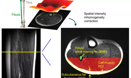 Study Reveals How Sex and Age Influence Fat Accumulation in Muscles and Bones