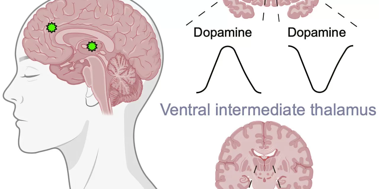 Groundbreaking Study Reveals How Brain Chemicals Respond to Emotional Words