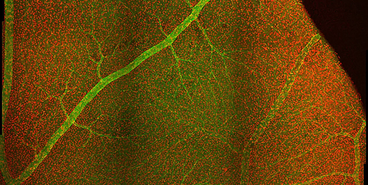 Eye Nerve Cells Work Together to Process Contrast and Movement: New Research Challenges 50-Year-Old Hypothesis