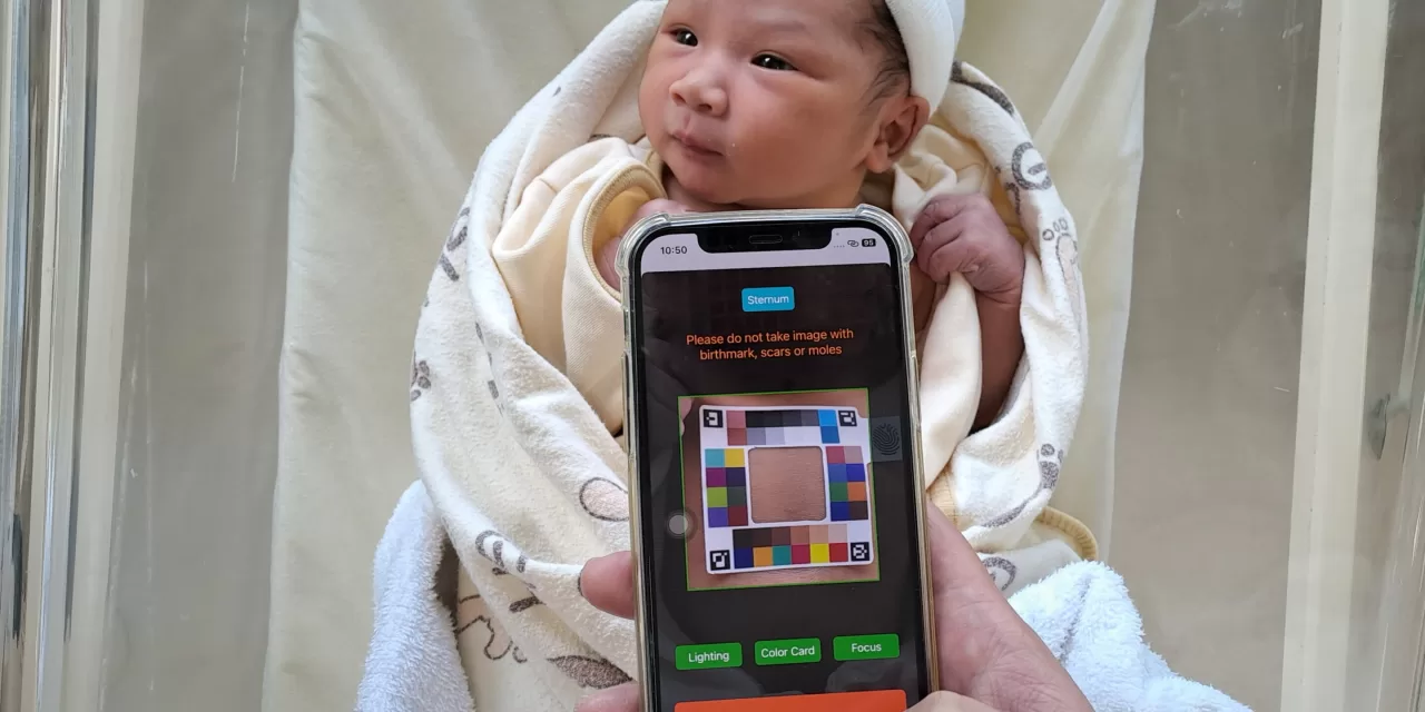 AI-Powered App Brings Infant Jaundice Screening Home for Asian Parents