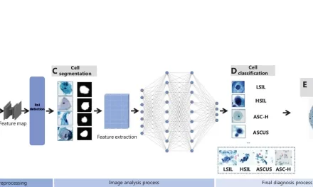 AI Can Enhance Cervical Cancer Detection with Medical Image Recognition