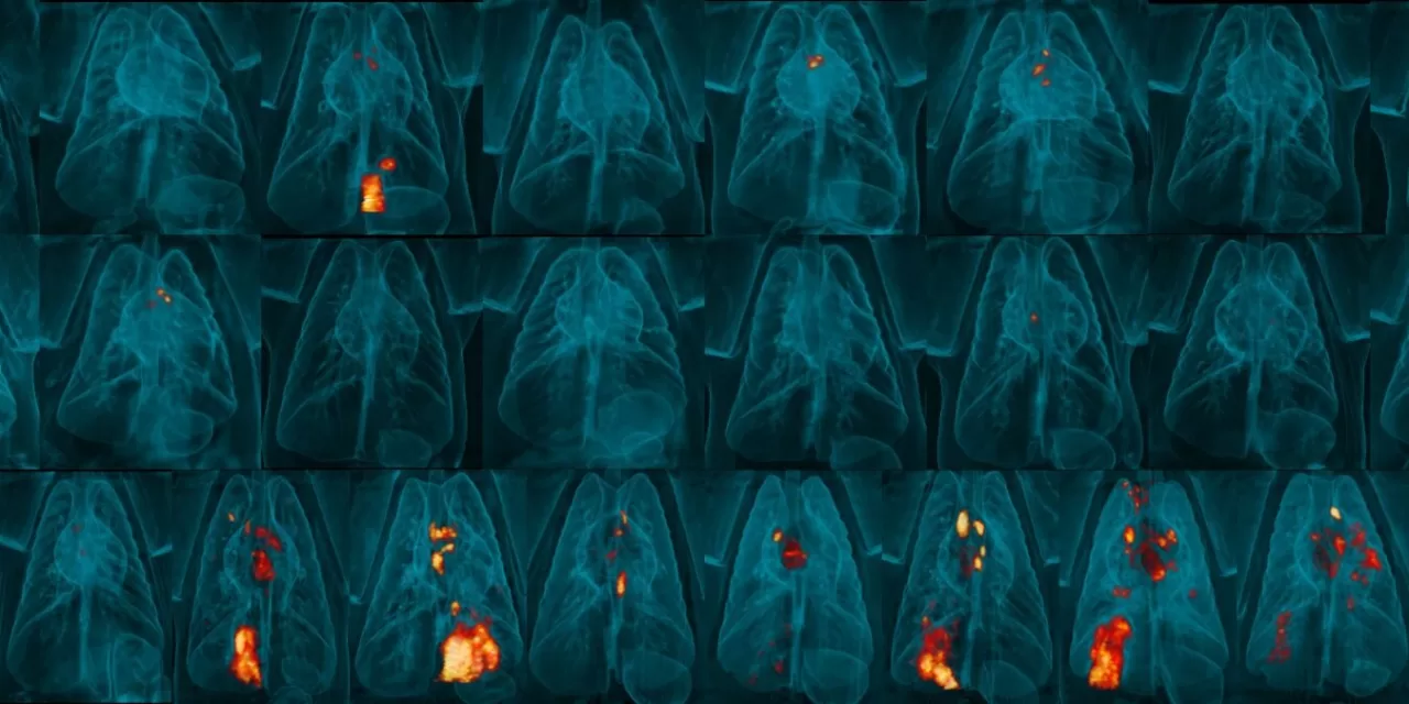 Self-Destructing Vaccine Shows Promise in Enhancing Tuberculosis Protection in Monkeys