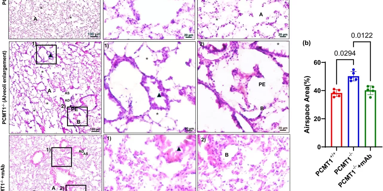 Breakthrough Discovery Offers Hope for Cure of Age-Related Lung Diseases