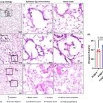 Breakthrough Discovery Offers Hope for Cure of Age-Related Lung Diseases