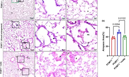 Breakthrough Discovery Offers Hope for Cure of Age-Related Lung Diseases