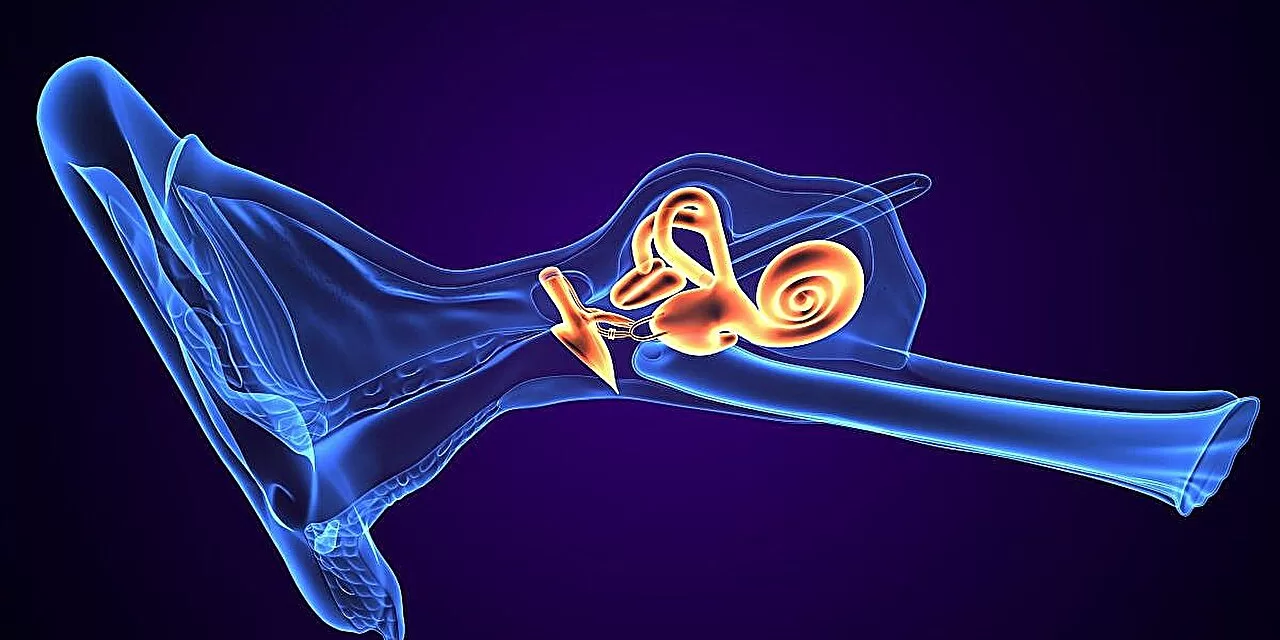 Triple Semicircular Canal Plugging Proves Effective in Controlling Vertigo in Meniere Disease, but Hearing Loss a Risk