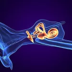 Triple Semicircular Canal Plugging Proves Effective in Controlling Vertigo in Meniere Disease, but Hearing Loss a Risk