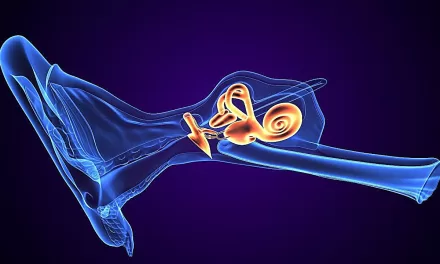 Triple Semicircular Canal Plugging Proves Effective in Controlling Vertigo in Meniere Disease, but Hearing Loss a Risk