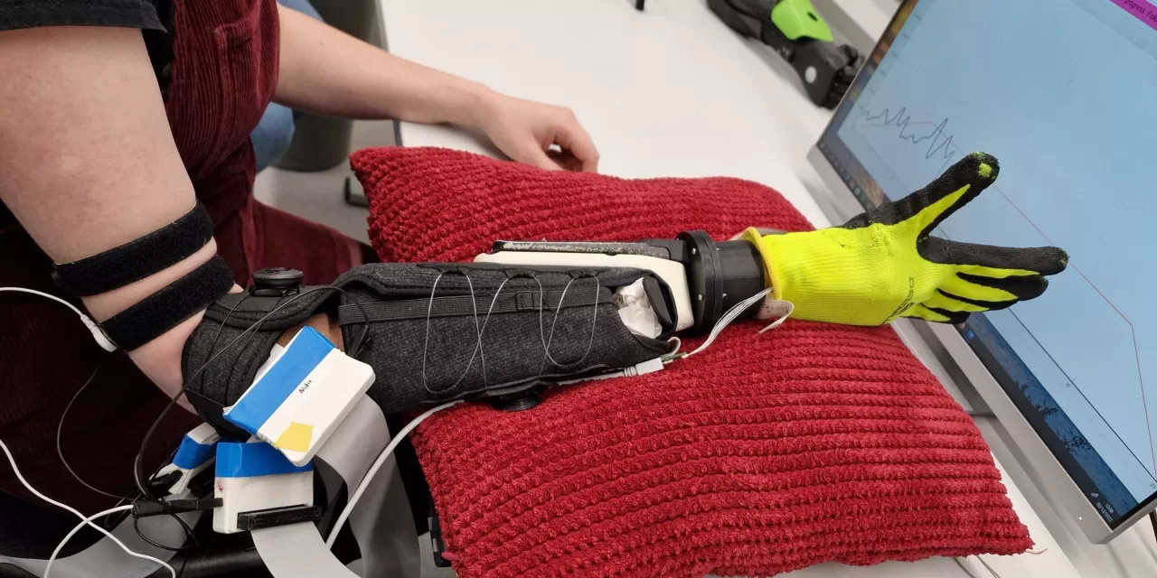 Prosthetic Limb Gains More Natural Control through Hand-Brain Connection