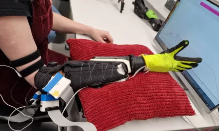 Prosthetic Limb Gains More Natural Control through Hand-Brain Connection