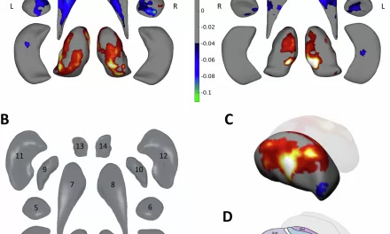 Global Study Identifies Markers for the Five Clinical Stages of Parkinson’s Disease