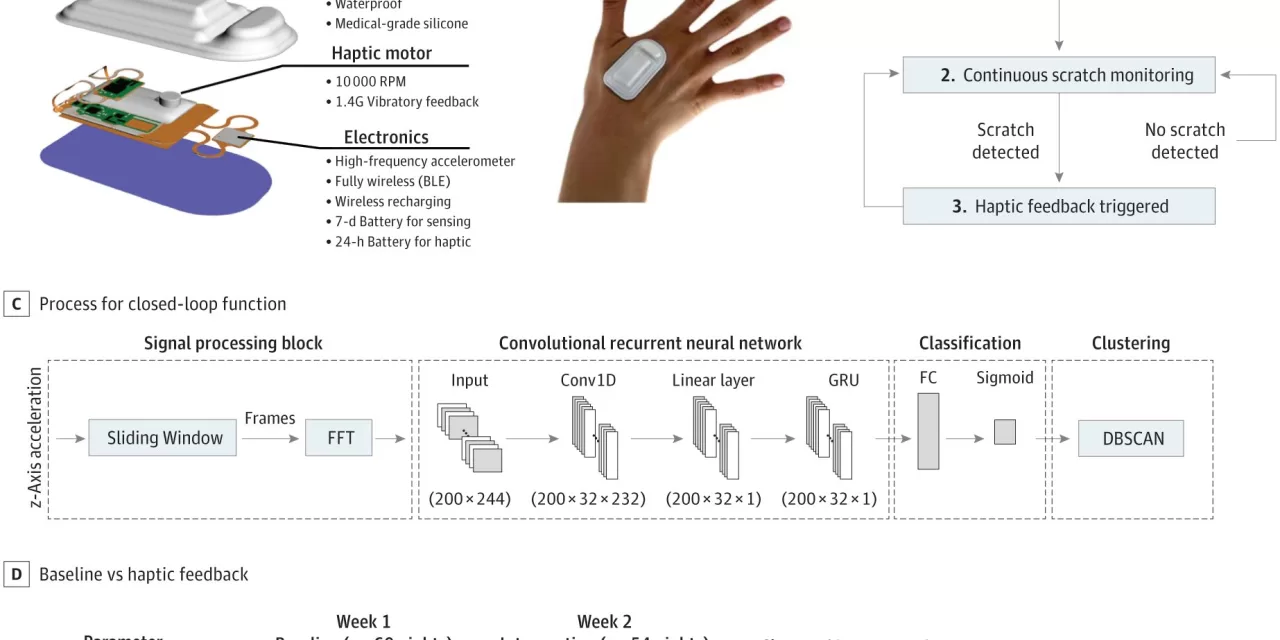 AI-Enabled Wearable Sensor Reduces Nocturnal Scratching in Atopic Dermatitis Patients