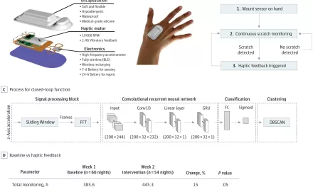 AI-Enabled Wearable Sensor Reduces Nocturnal Scratching in Atopic Dermatitis Patients