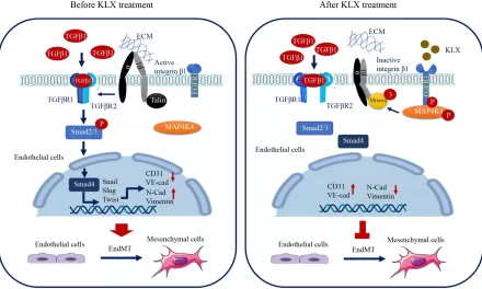 Novel Compound Kanglexin Shows Promise in Atherosclerosis Treatment