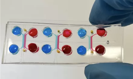 Gut-on-Chip Technology Predicts Immunotherapy Outcomes for Melanoma Patients