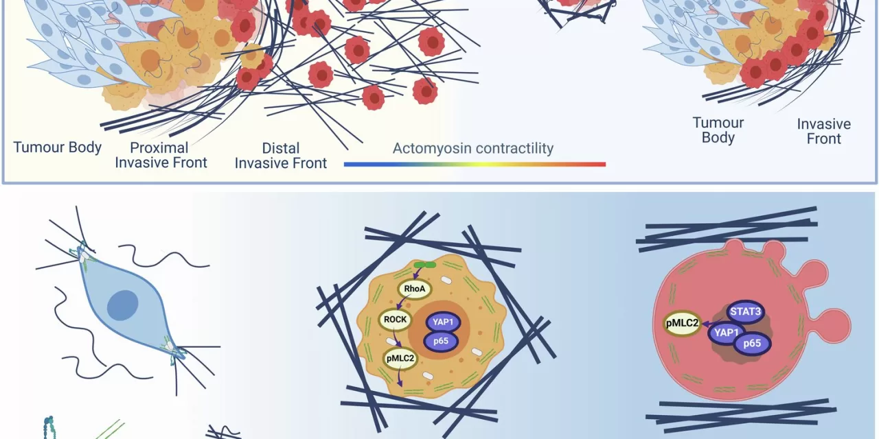 Scientists Unveil ‘Roadmap’ Cancer Cells Use to Spread, Opening Door to Early Treatment