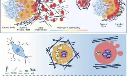 Scientists Unveil ‘Roadmap’ Cancer Cells Use to Spread, Opening Door to Early Treatment