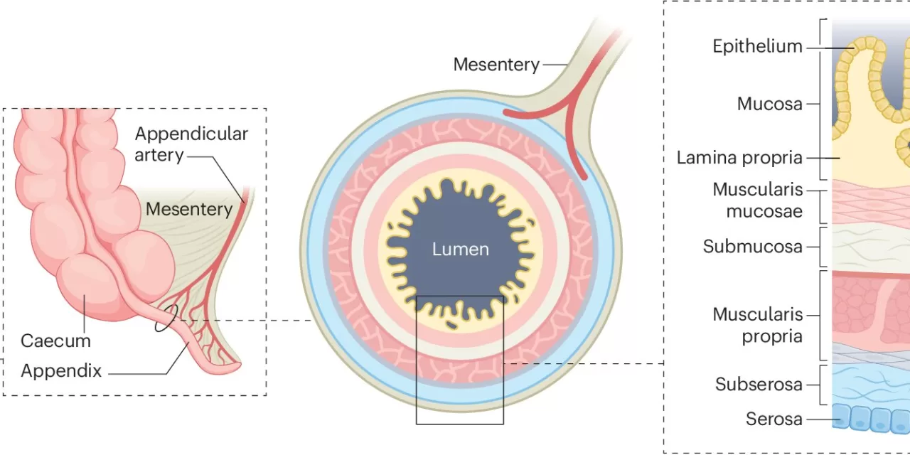 Researchers Publish Action Plan to Address Appendiceal Cancer Enigmas