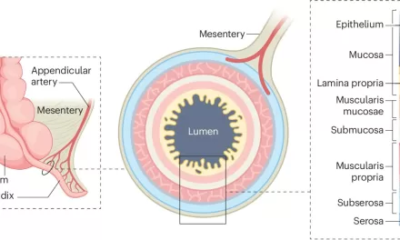 Researchers Publish Action Plan to Address Appendiceal Cancer Enigmas