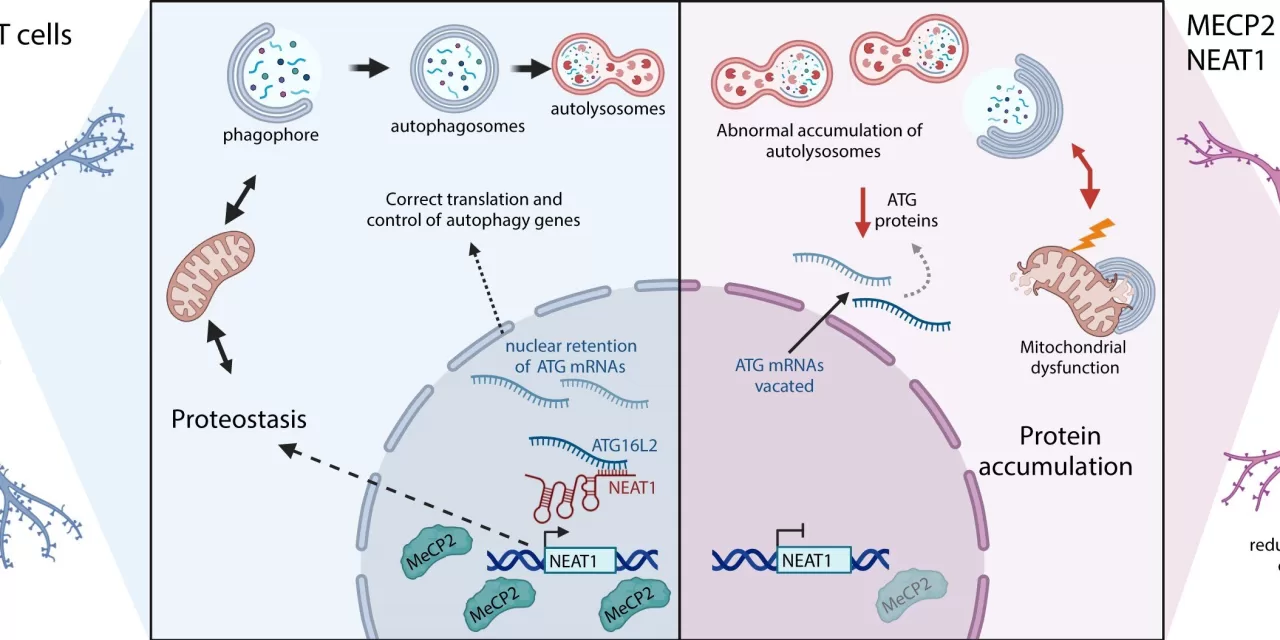 Autophagy Malfunction Study Brings New Insights into Rett Syndrome