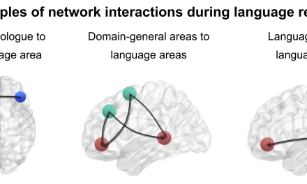 How the Brain Rewires Itself for Language Recovery After a Stroke