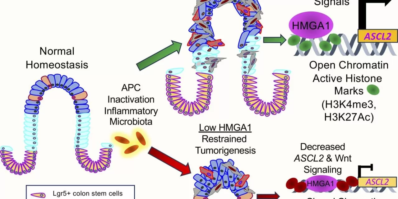 Scientists Identify Epigenetic Key That ‘Opens’ Door to Colon Cancer