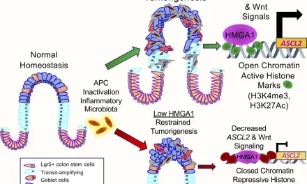 Scientists Identify Epigenetic Key That ‘Opens’ Door to Colon Cancer