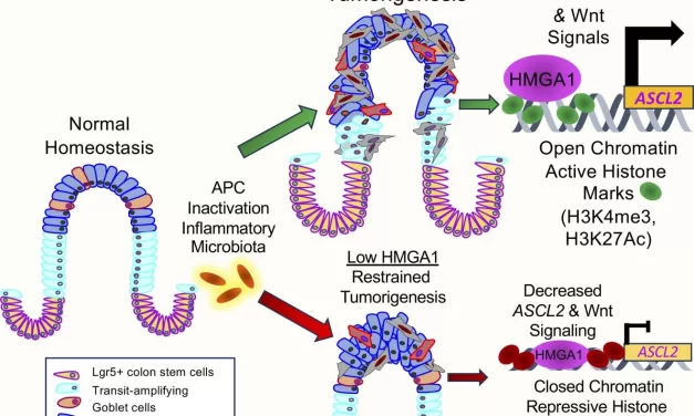 Scientists Identify Epigenetic Key That ‘Opens’ Door to Colon Cancer