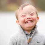 CRISPR Snips Away Extra Chromosomes, Offering New Hope for Down Syndrome Treatment