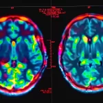 New MRI Study Reveals How Cannabis Alters Brain Activity and Weakens Memory