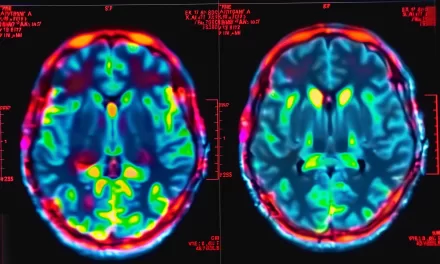 New MRI Study Reveals How Cannabis Alters Brain Activity and Weakens Memory