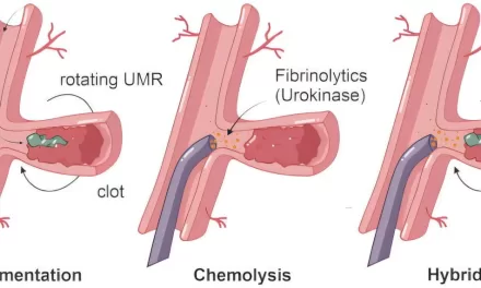 Magnetic Microrobots Successfully Remove Blood Clots from Sheep Iliac Artery