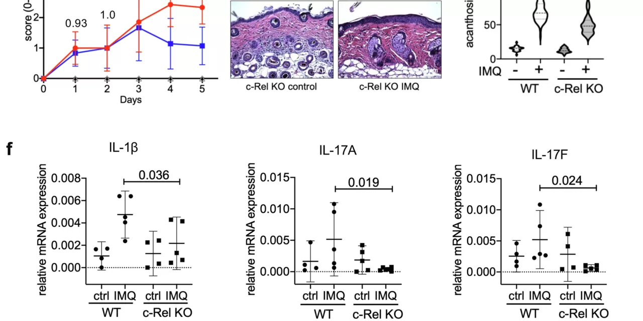 Key Protein that Intensifies Psoriasis Identified in Groundbreaking Study