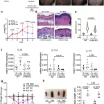 Key Protein that Intensifies Psoriasis Identified in Groundbreaking Study