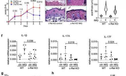 Key Protein that Intensifies Psoriasis Identified in Groundbreaking Study