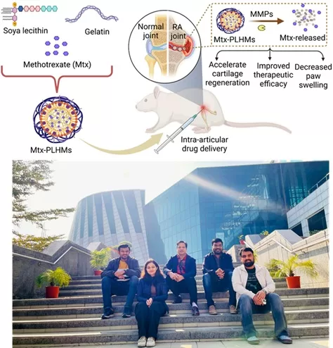 Innovative drug delivery system could revolutionize treatment of Rheumatoid Arthritis (RA)