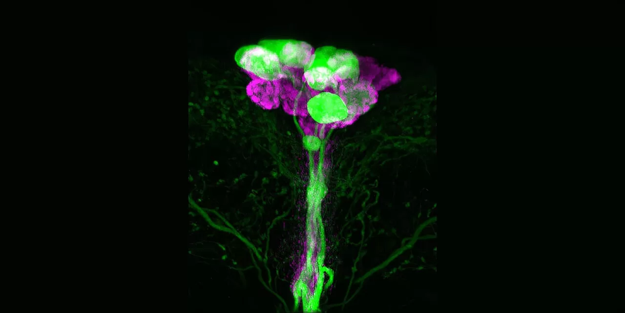 Fruit Fly Research Unveils New Insights Into Insulin Production: Implications for Diabetes and Metabolic Diseases