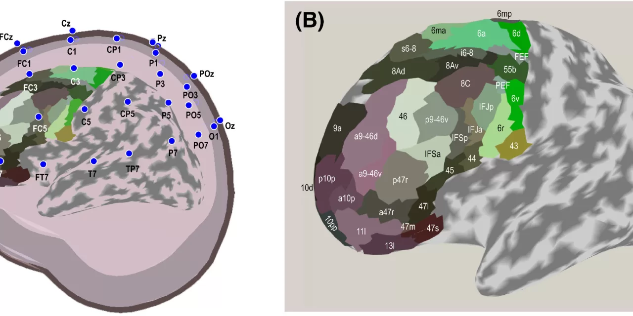 Electroencephalography May Help Guide Treatments for Language Disorders